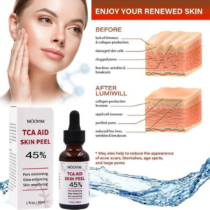 [ TCA 45% SKIN PEEL ] MOOYAM TCA 45% Skin Peel Anti-aging Reduce Acne And Dark Spots Even Skin Tone Cleanses Shrink Pores And Brightens Skin Tone Reduces Wrinkles And Fine Lines Peeling Solution With Malic Acid And Citric Acid Natural Exfoliation of Skin.